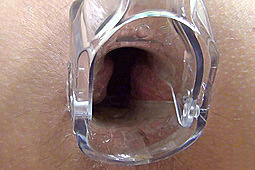 Ton in Speculum Before an Enema by 